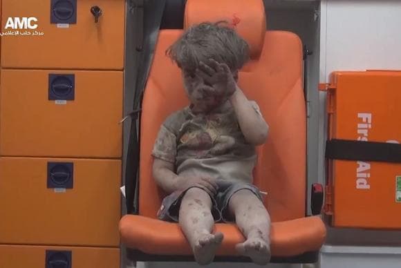 DESUMANO: Imagem de criança ferida após ataque em Aleppo choca o mundo