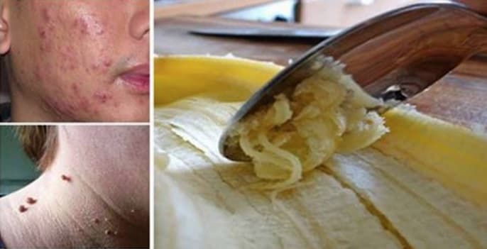 Após ler isto você nunca mais jogará fora esta parte tão preciosa da banana