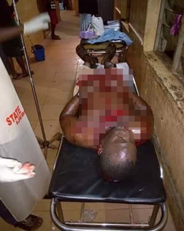 Durante sexo com a esposa, homem admite traição e acaba esfaqueado por ela