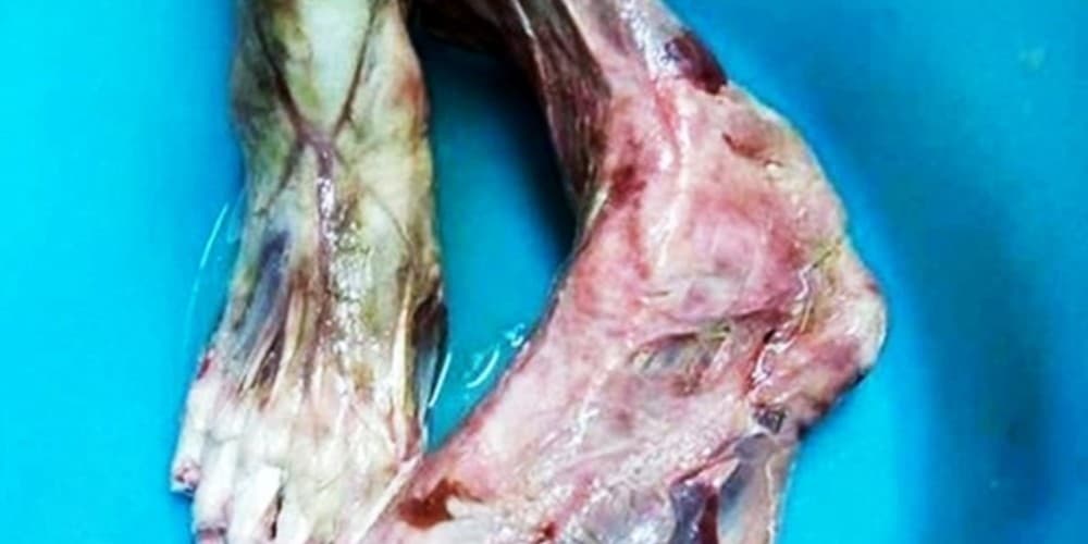 Restaurante chinês é acusado de servir carne humana