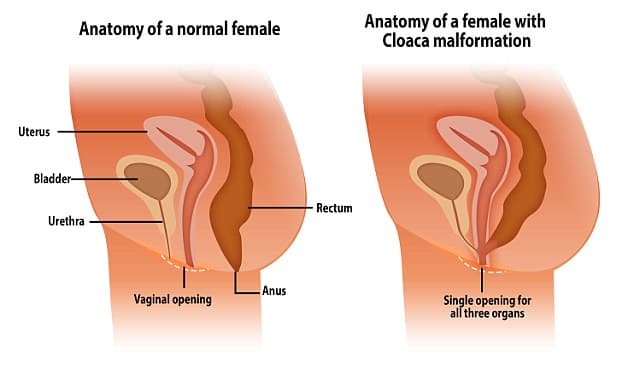 Mulher engravida por meio de sexo anal e médicos ficam chocados ao descobrirem o motivo