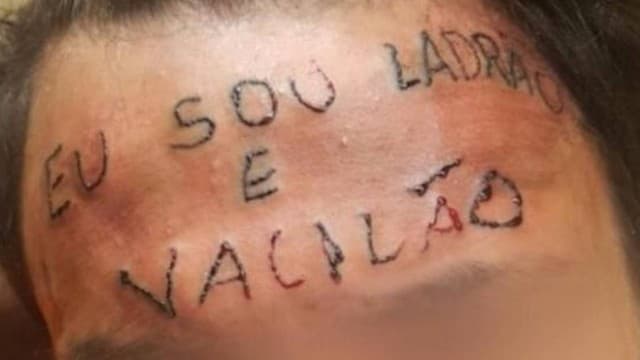 Campanha para remover tatuagem de jovem torturado visa a arrecadar R$ 15 mil