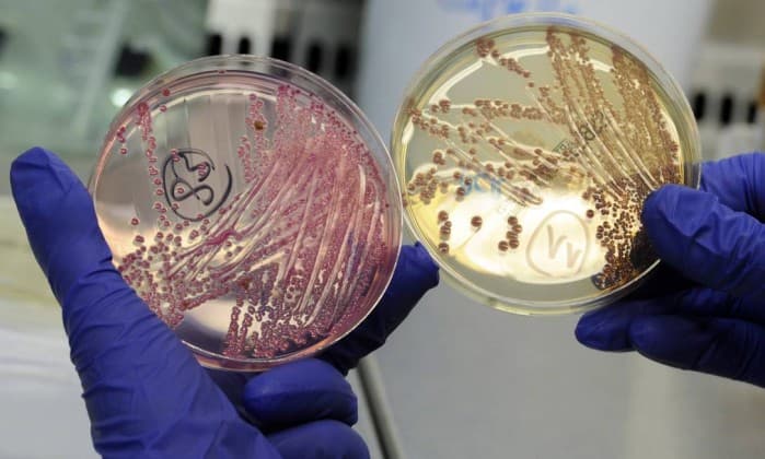 EUA têm primeiro caso de bactéria resistente ao ‘último antibiótico'