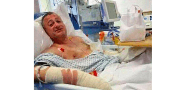 FOTOS: "Herói" de 47 anos sai na mão com 3 terroristas, leva facadas e sobrevive em Londres