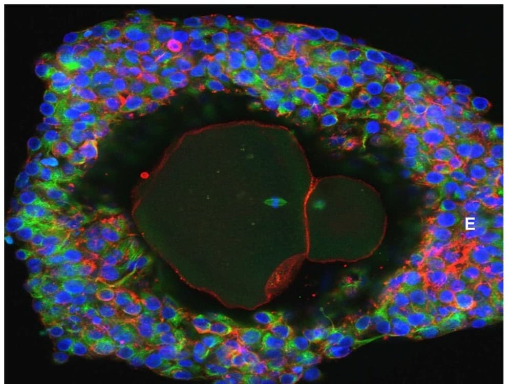 Cientistas criam óvulos humanos em laboratório pela primeira vez