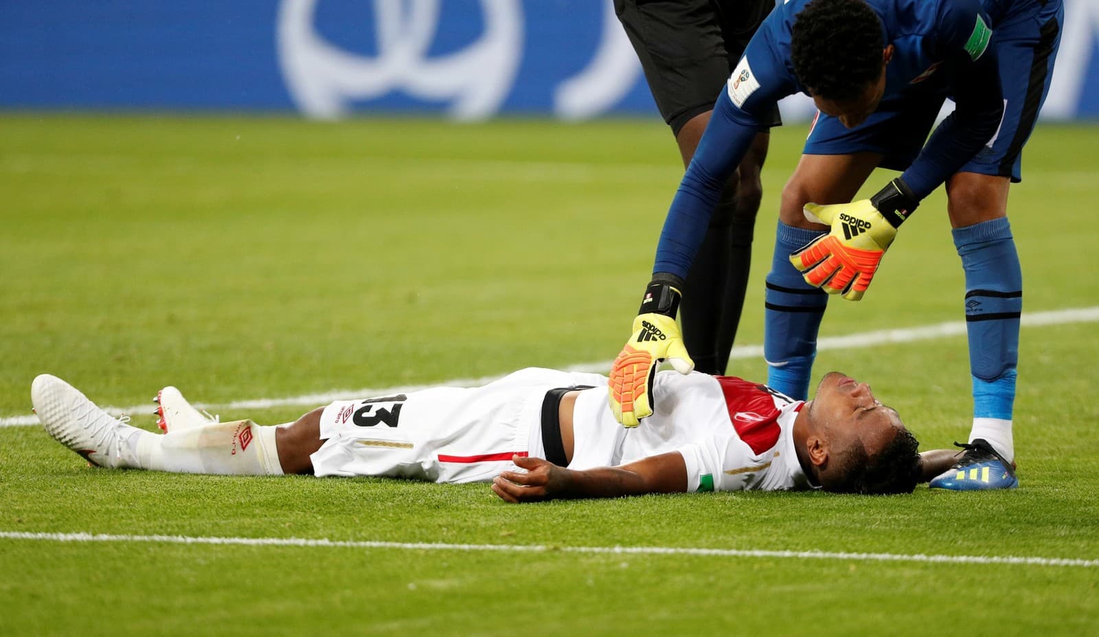 Após pancada, meia do Peru não lembra de jogo contra a Dinamarca
