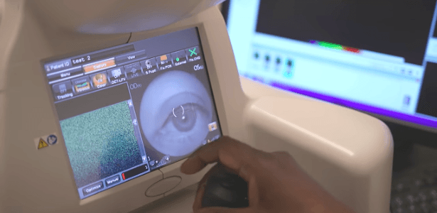 Aparelho da Google identifica mais de 50 doenças oculares melhor que médicos