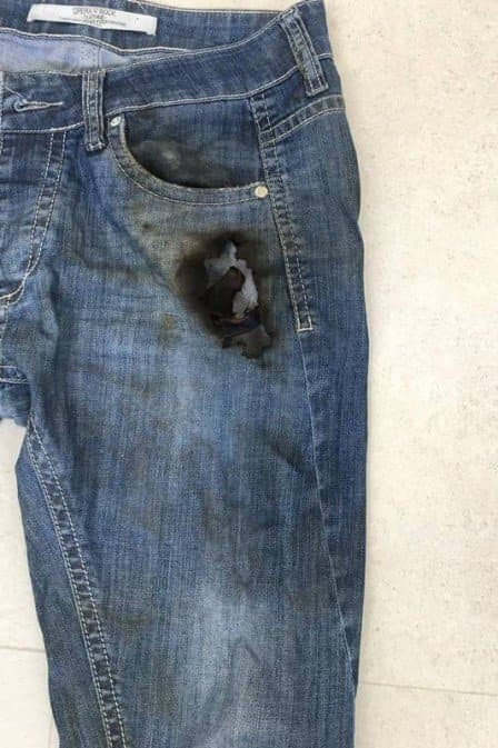 FOTOS: Celular pega fogo no bolso da calça e deixa homem com queimaduras na perna e mãos no RJ