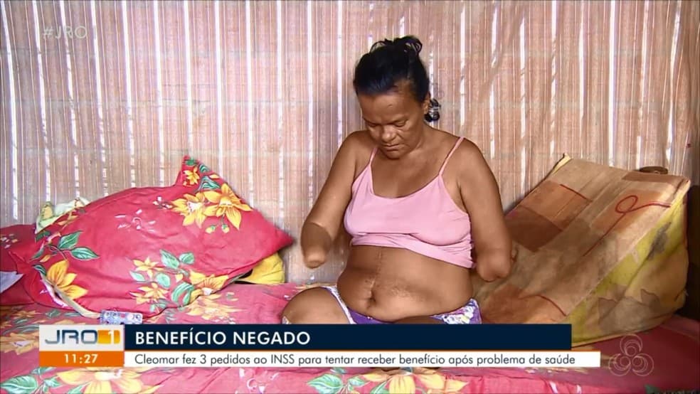 Mulher sem mãos e pernas tem pedido de benefício negado pelo INSS por não poder assinar papel