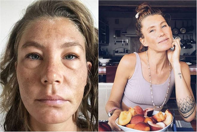 Mulher diz que não bebe água há um ano e que ‘jejum seco' a curou