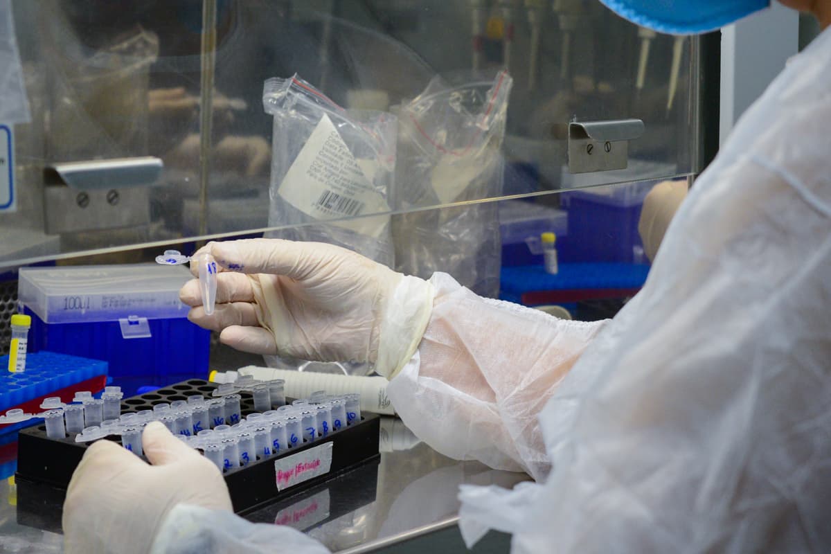 UFRN adquire kits e começa a testagem para Covid-19