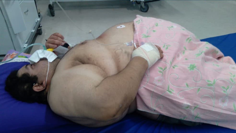 Homem no interior do RN com quase 300 quilos aguarda transferência para UTI em colchão no chão de hospital