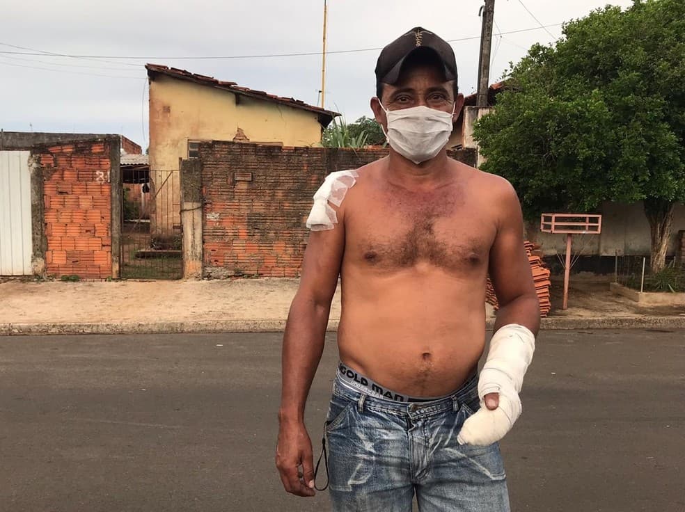 FOTOS: Vizinho estoura grade de janela e salva bebê de incêndio em SP