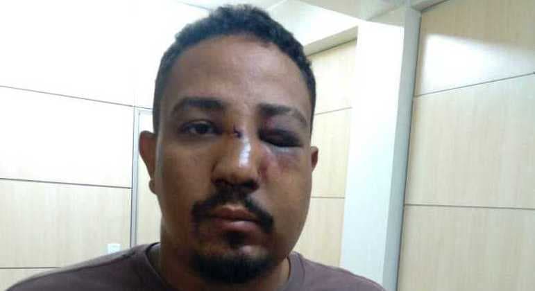 Cartomante é espancado, sofre fratura e tem dentes quebrados após homem ficar inconformado com leitura de tarô