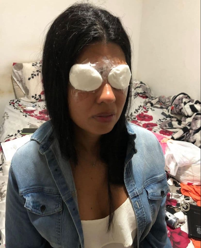 ALERTA: Jovem potiguar fica temporariamente cega após usar pomada no cabelo para fazer tranças