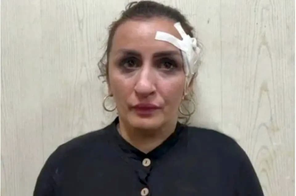 Mulher é presa após vender o filho para financiar plástica no nariz