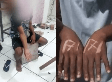 “Vi a morte”, diz jovem espancado e marcado a ferro por patrão na Bahia