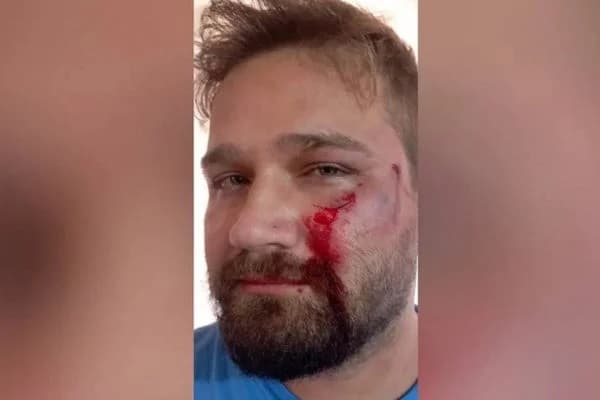 Médico é agredido com capacete após negar atestado para adolescente