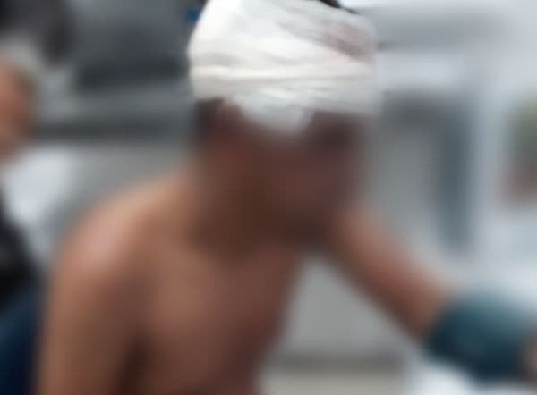 População espanca foragido por roubo e ele vai para o hospital com suspeita de traumatismo na Grande Natal