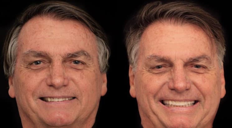 Bolsonaro faz harmonização orofacial em clínica de Goiânia
