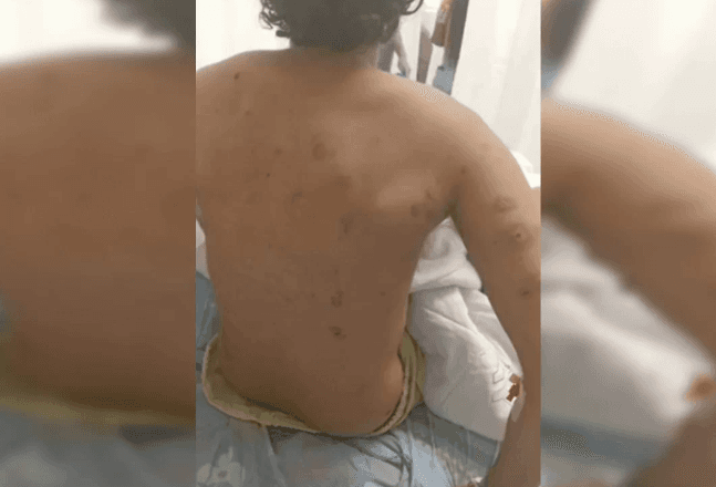 Brasileiro ferido em Israel foi atingido por estilhaços de granada atirada pelo Hamas