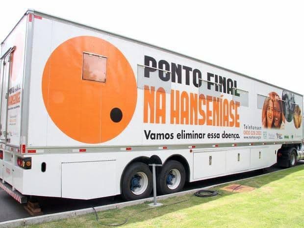 Carreta da Hanseníase chegará a Parnamirim para testes, diagnóstico precoce e tratamento da doença na população