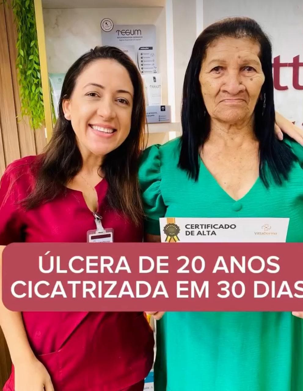 Milagre em 30 Dias: Cicatrização de Úlcera Venosa Após 20 Anos - A Revolução VittaDerma