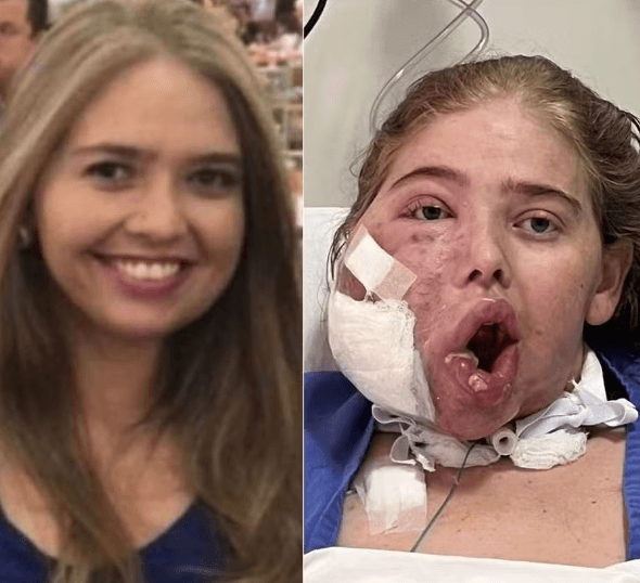 ‘Tenho certeza da minha cura', diz potiguar que luta contra tumor grave no rosto