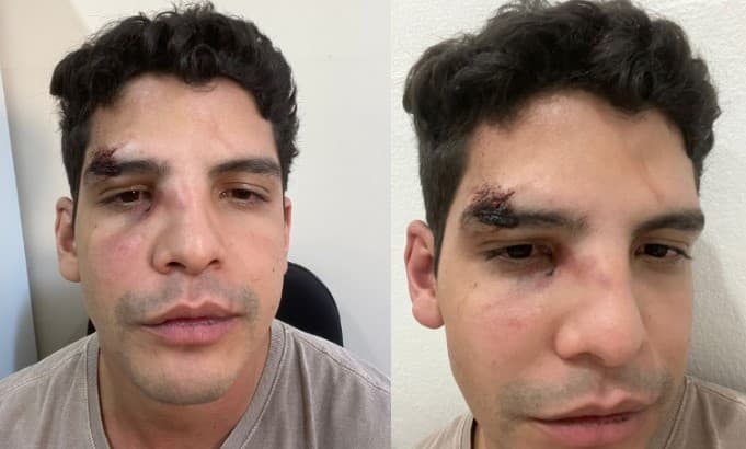 VÍDEO E FOTOS: Comunicador Miqueias Avelino é agredido pelo ex-namorado, o médico Thiago Ramos