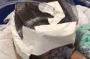 Escassez de equipamentos no RN faz médicos improvisarem
