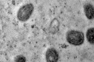 OMS alerta para variante mais perigosa da varíola dos macacos