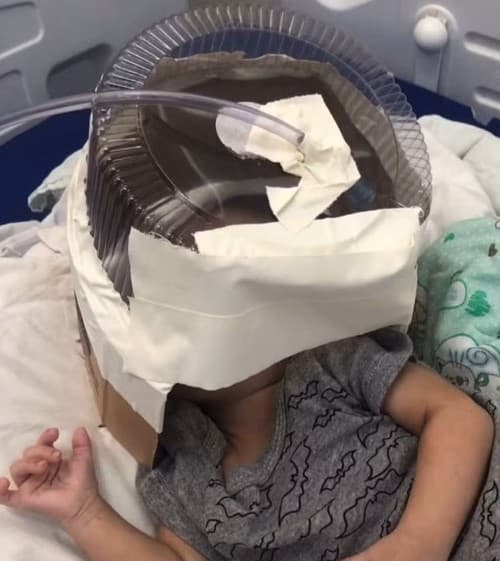Morre em Natal bebê que precisou de máscara de oxigênio improvisada com embalagem de bolo