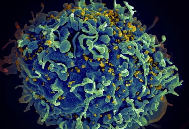 HIV: cientistas anunciam 7º paciente curado após transplante de medula óssea cujo doador era resistente ao vírus