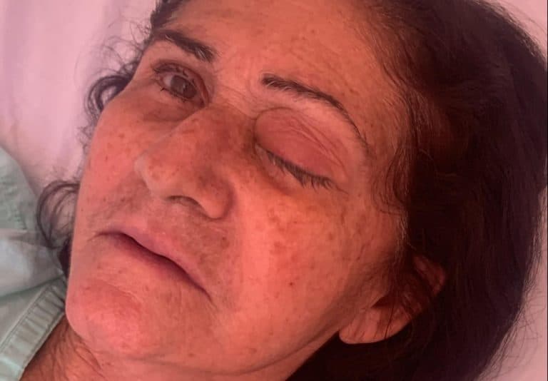 Mulher perde a visão após passar por mutirão de cirurgias de catarata em Parelhas