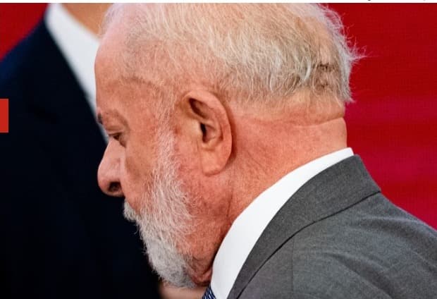 Lula está estável e sem sequelas após cirurgia no cérebro