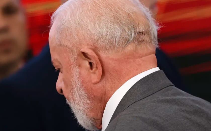 Após cirurgia, Lula vai ficar 48 horas na UTI e retorno a Brasília deve ocorrer na próxima semana, diz médico
