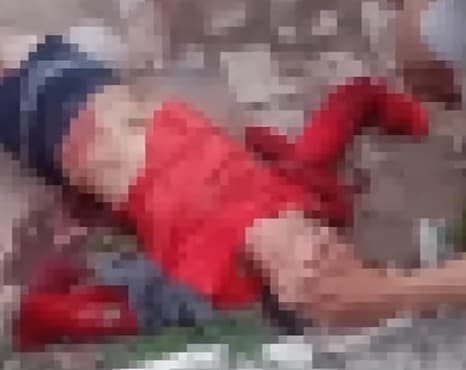 IMAGEM FORTE: Homem tem mãos dilaceradas após ser atacado por pitbulls em Extremoz