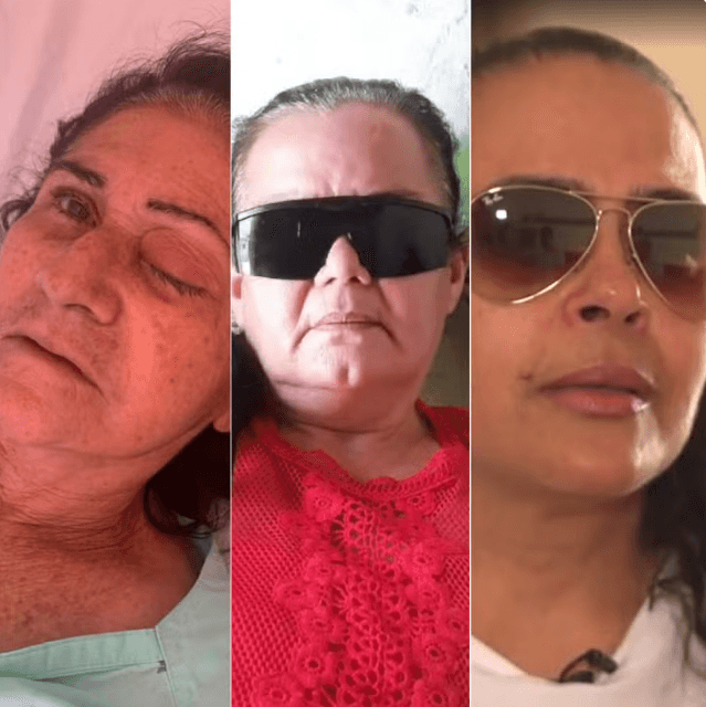 Mutirão de cirurgias de cataratas no RN: quase 6 meses depois, pacientes que perderam globo ocular não receberam indenização