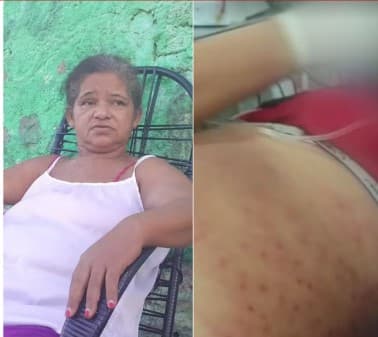 Mulher que levou 1,5 mil picadas de abelhas na Grande Natal deixa hospital após quase um mês: ‘Voltar para minha família'