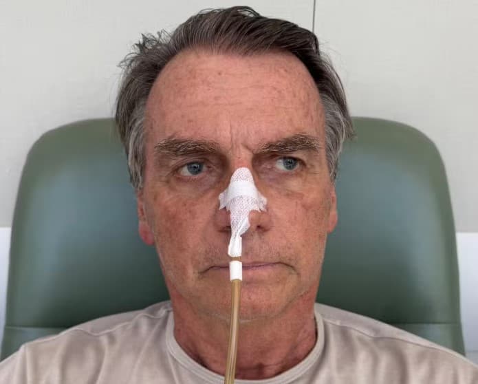 Bolsonaro faz tratamento para controlar alterações no fígado; Ex-presidente ainda não apresentou movimentos intestinais espontâneos