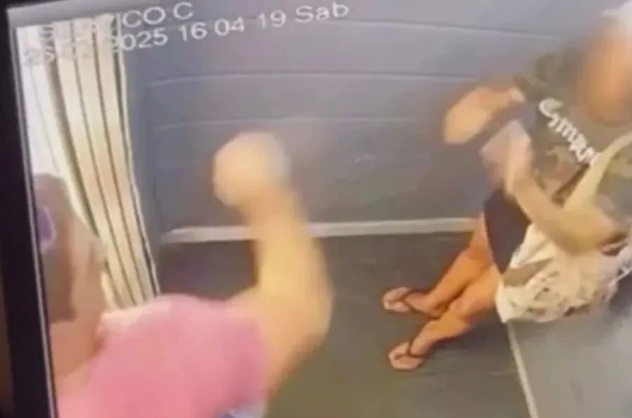 Mulher agredida pelo namorado no elevador em Natal é internada para primeira cirurgia de reconstrução facial