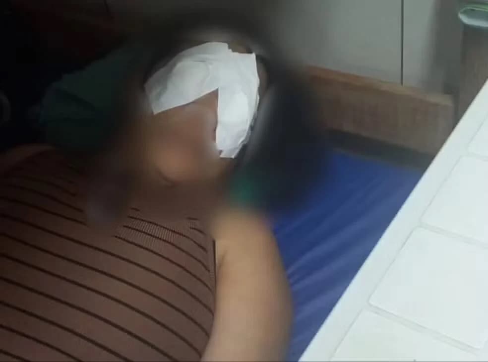 Servidora do Walfredo Gurgel sofre queimadura nos olhos após exposição a produto tóxico, diz sindicato