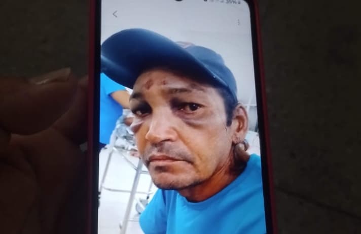 Paciente com traumatismo craniano some do Walfredo Gurgel e morre na rua; família exige respostas