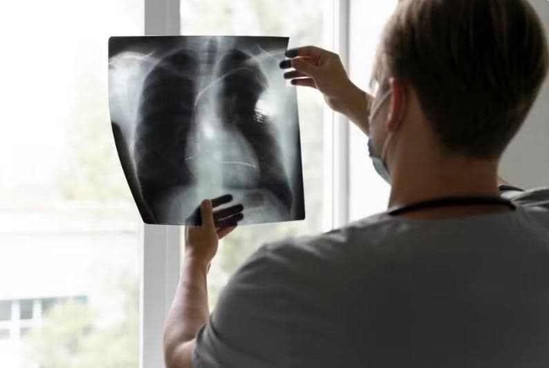Vacina inédita contra câncer de pulmão avança para testes em humanos e abre nova fronteira na prevenção
