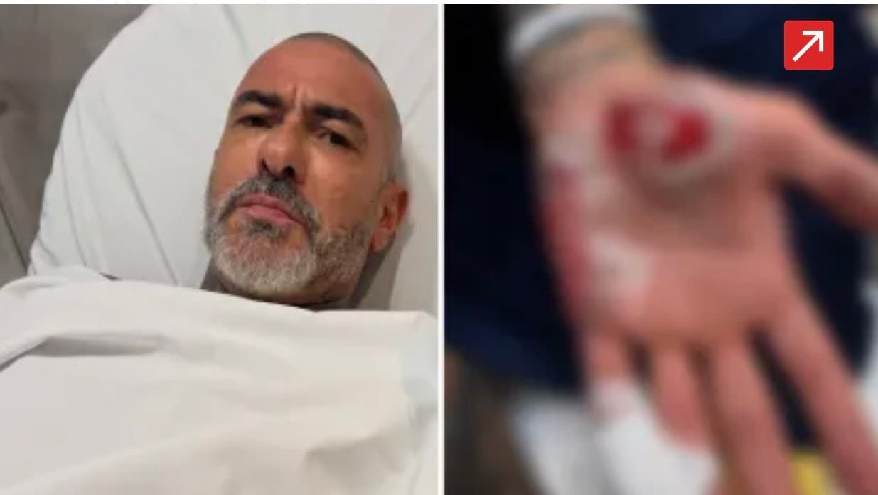Fogaça sofre acidente de moto e denuncia roubo de aliança em hospital