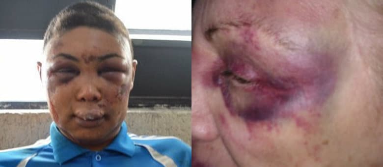 Caso do travesti Verônica em SP divide internautas no país: vítima ou algoz?