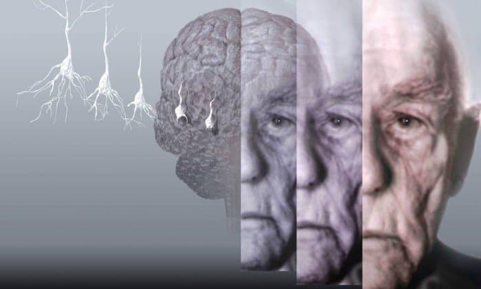 Proteína pode ser a chave para o tratamento de várias doenças neurodegenerativas