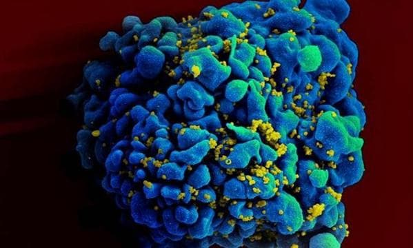 Novo anticorpo potente consegue reduzir significativamente quantidade de HIV no sangue