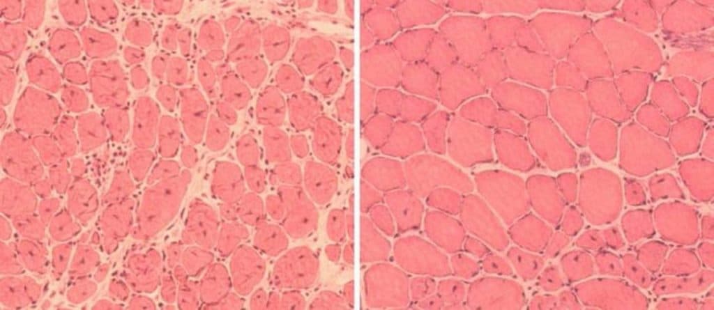 IMPRESSIONANTE: Cientistas revertem sinais do envelhecimento em camundongos