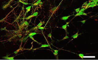Estudo brasileiro impede células-tronco de formar tumores e ‘cura' Parkinson